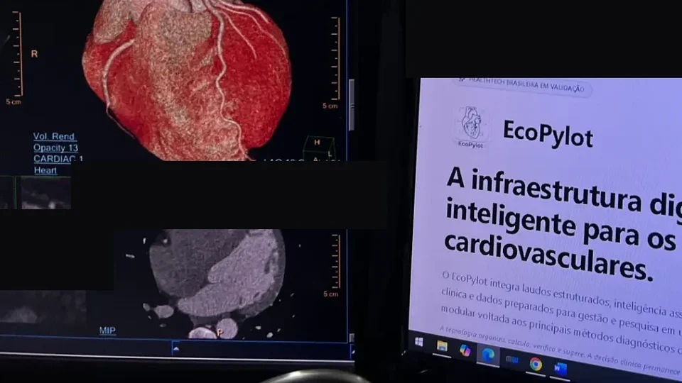 Imagem de angiotomografia coronariana e plataforma EcoPylot em ambiente de tomografia cardiovascular.