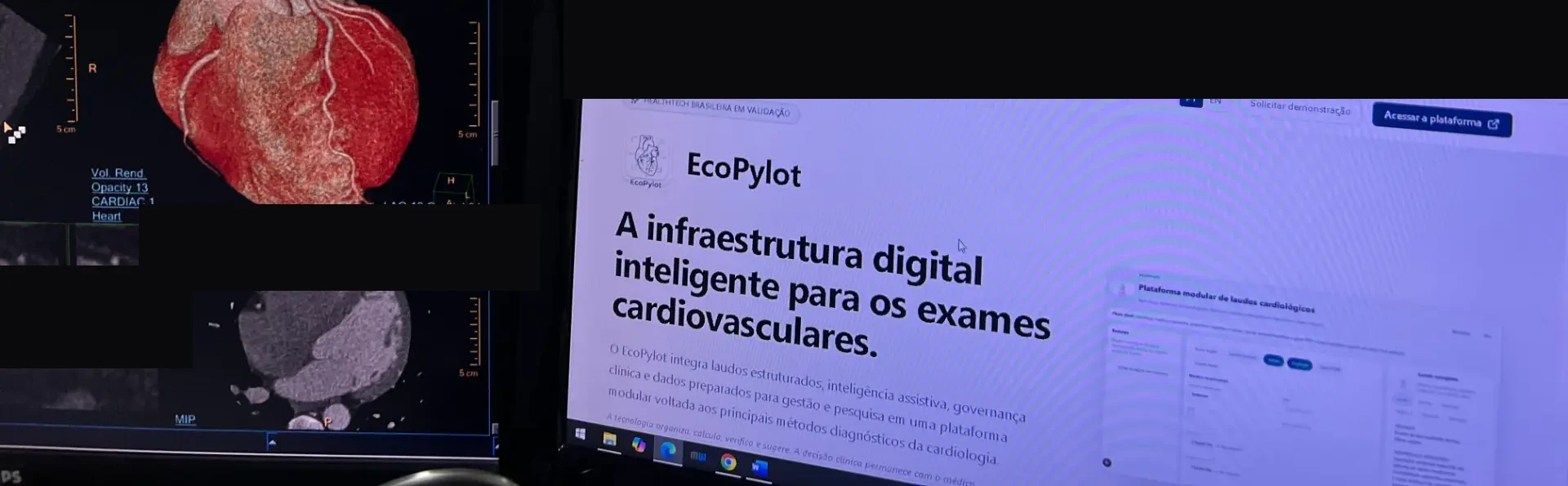 Imagem de angiotomografia coronariana e plataforma EcoPylot em ambiente de tomografia cardiovascular.